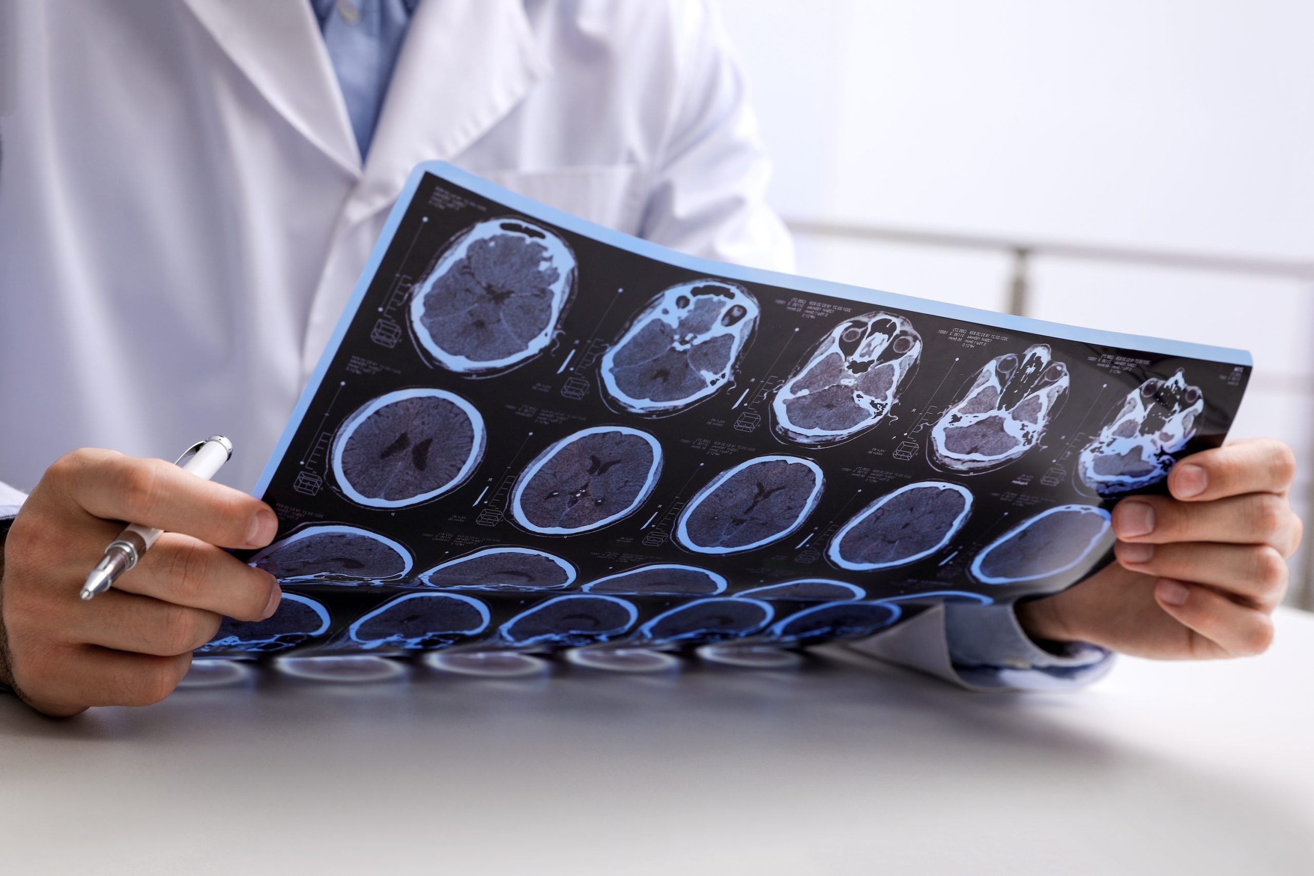 Arzt betrachtet die Aufnahmen eines menschlichen Gehirns, Neurologische Praxis Dr. Hartmut Bauer, Euskirchen Arzt betrachtet die Aufnahmen eines menschlichen Gehirns, Neurologische Praxis Dr. Hartmut Bauer, Euskirchen