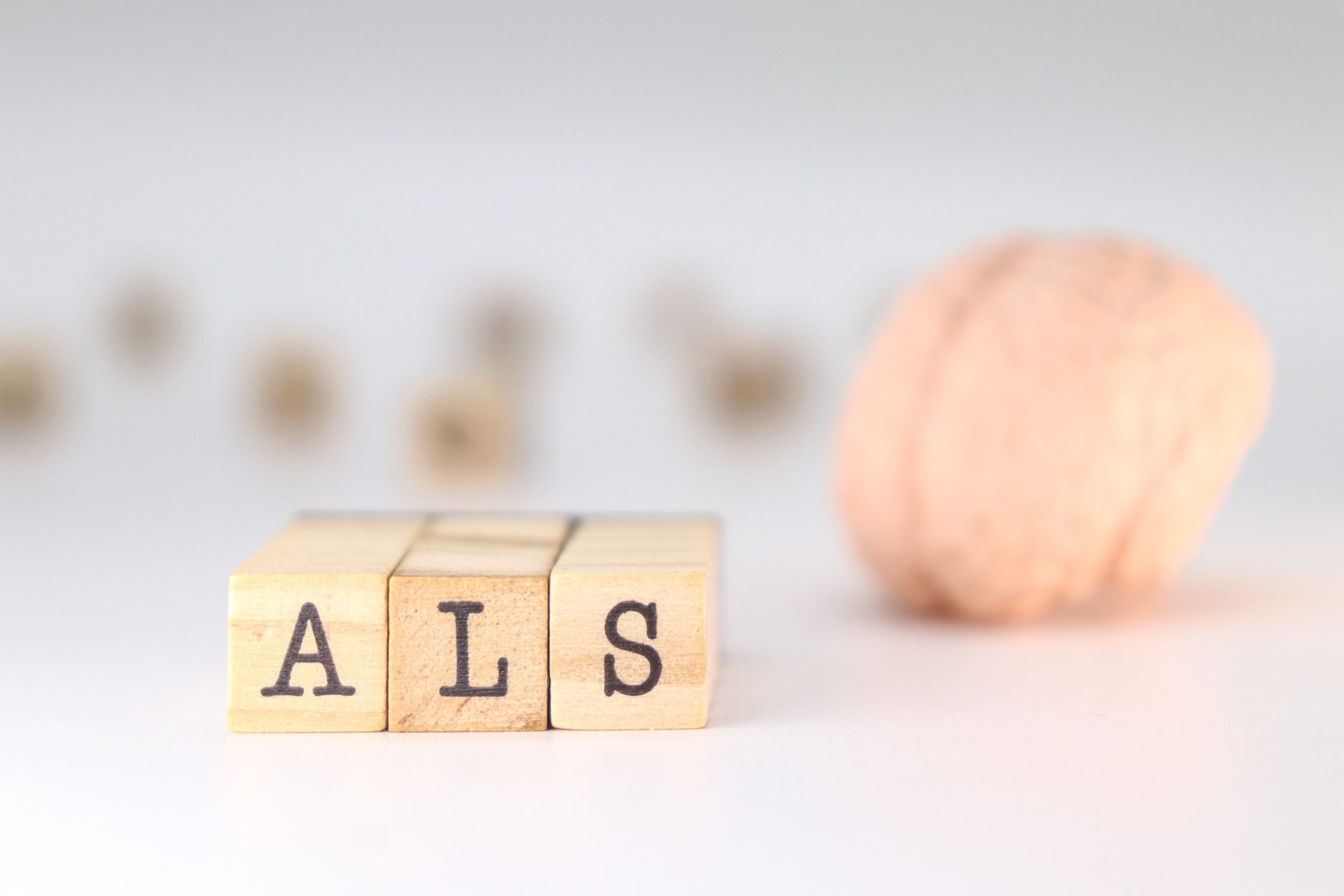 Drei Holzwürfel mit den drei Buchstaben A L und S, Beispielfoto für Amyotrophe Lateralsklerose (ALS) / Muskelschwund, Neurologische Praxis Dr. Hartmut Bauer, Euskirchen Drei Holzwürfel mit den drei Buchstaben A L und S, Beispielfoto für Amyotrophe Lateralsklerose (ALS) / Muskelschwund, Neurologische Praxis Dr. Hartmut Bauer, Euskirchen